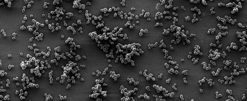 The extraordinary & infinite world of non-Saccharomyces yeast